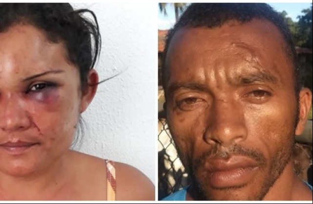 Mulher espancada pelo marido em Castelo do PiauÃ­