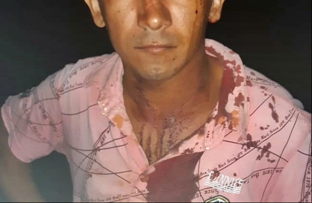 Homem Ã© baleado na cabeÃ§a apÃ³s discussÃ£o com o prÃ³prio irmÃ£o no PI
